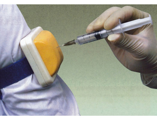 ����ע��ģ��