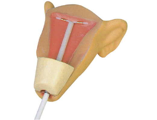 �߼��m�ȱ�����Ӗ��ģ��