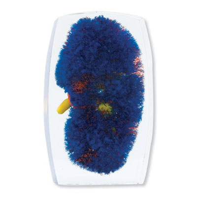 �IѪ��ģ�ͣ��t���S���{��